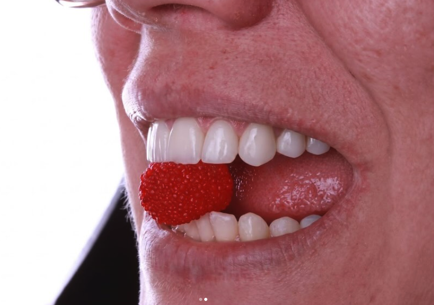Clareamento dental